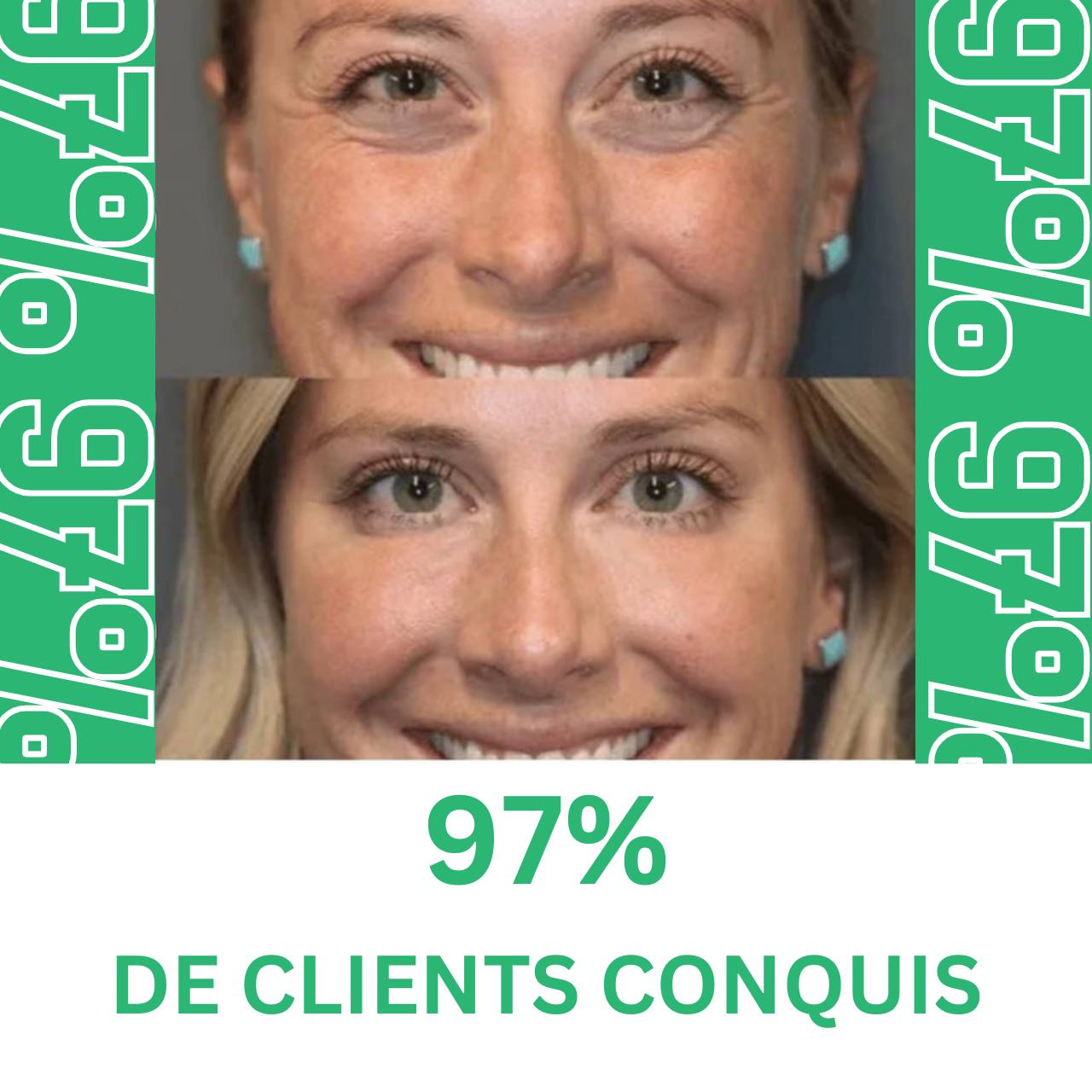 Crème Anti Cernes et Rides Instantannée
